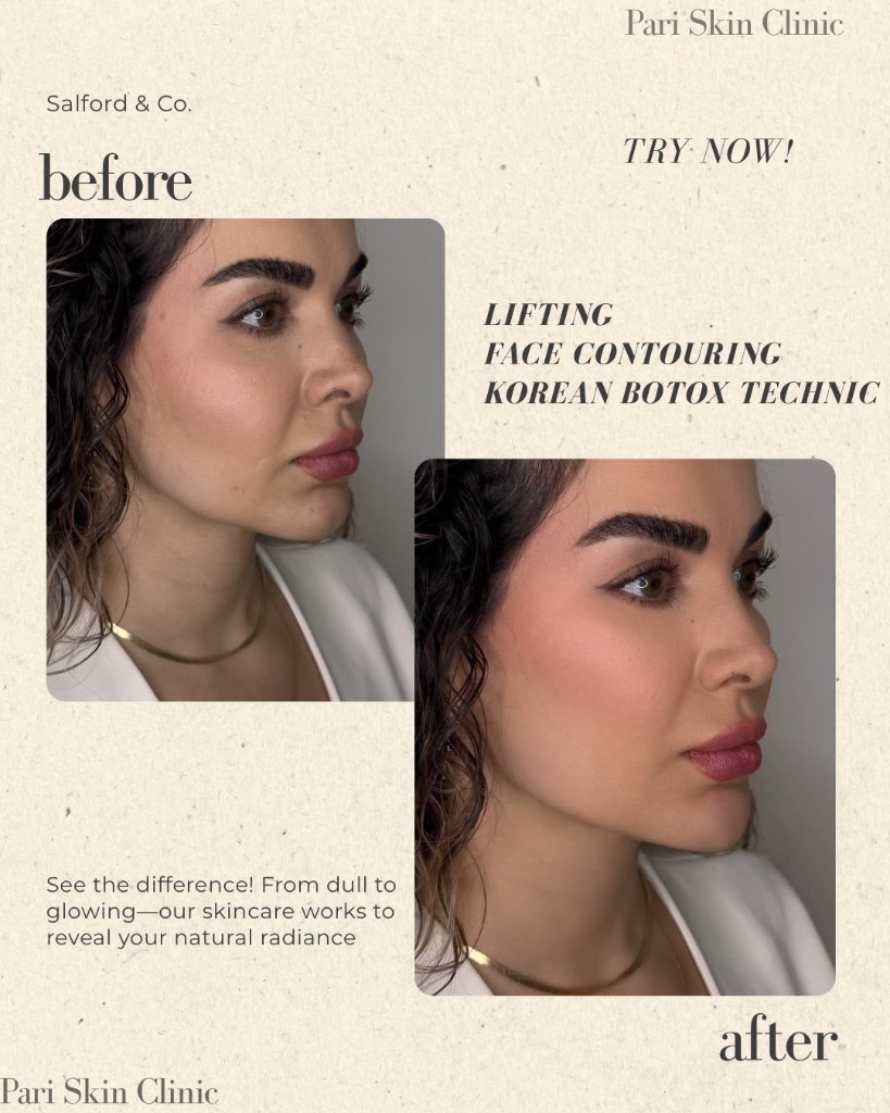 Voor en na Korean Botox lifting en face contouring bij Pari Skin Clinic