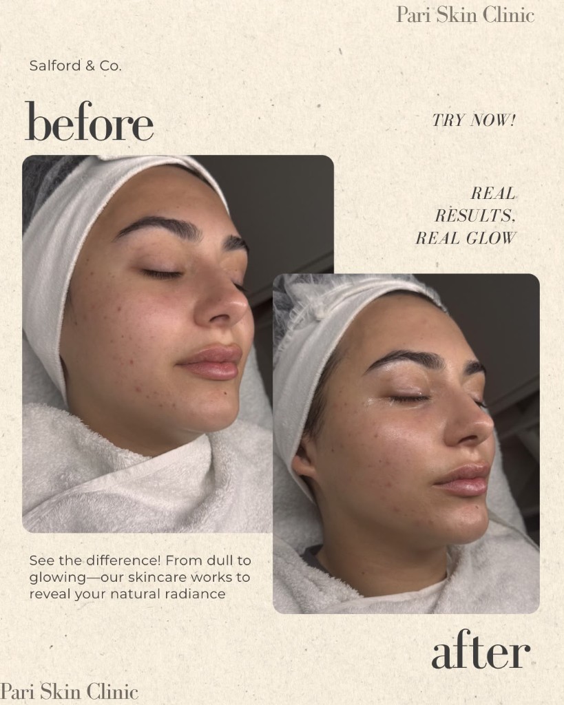 Voor en na huidverheldering bij Pari Skin Clinic