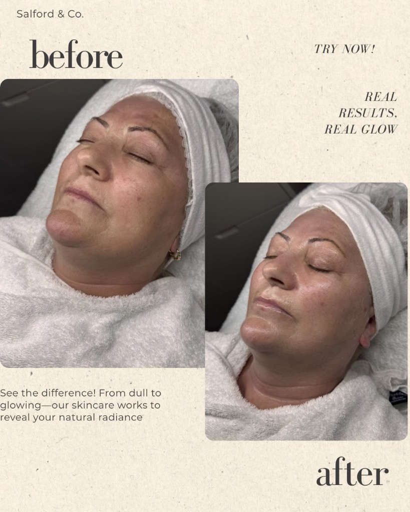 Voor en na facial met natuurlijke glow bij Pari Skin Clinic